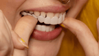 Instant Smile Veneer Set - Removable Upper and Lower Teeth Veneers