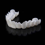 Instant Smile Veneer Set - Removable Upper and Lower Teeth Veneers