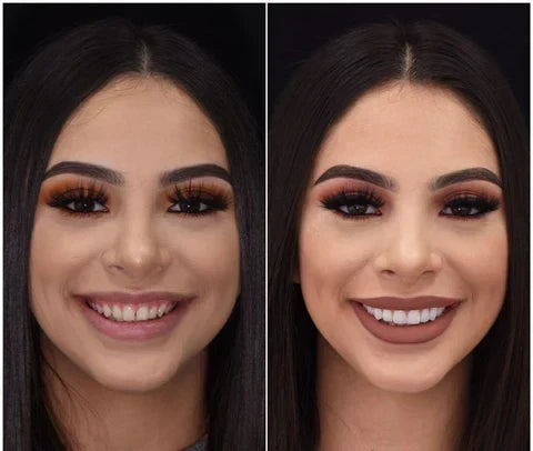 Instant Smile Veneer Set - Removable Upper and Lower Teeth Veneers